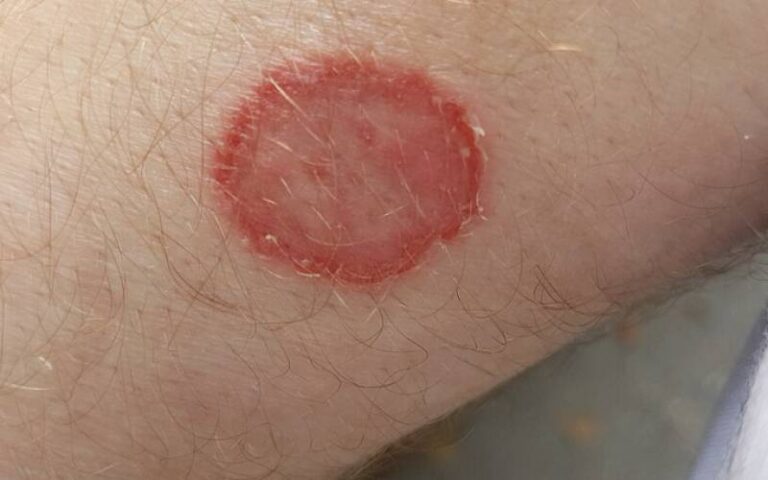 1000264680 11773395790 large