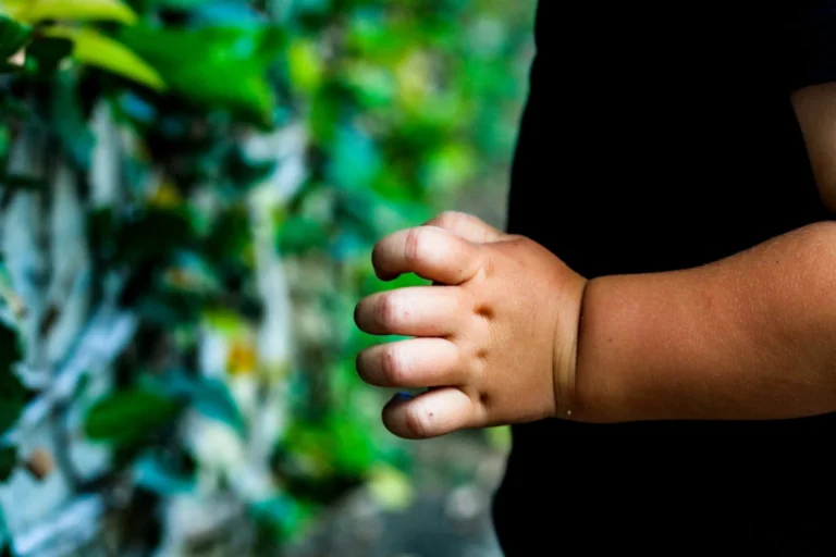 Meer dan één op de drie kinderen in Andalusië heeft overgewicht overheid komt met speciaal gezondheidsplan